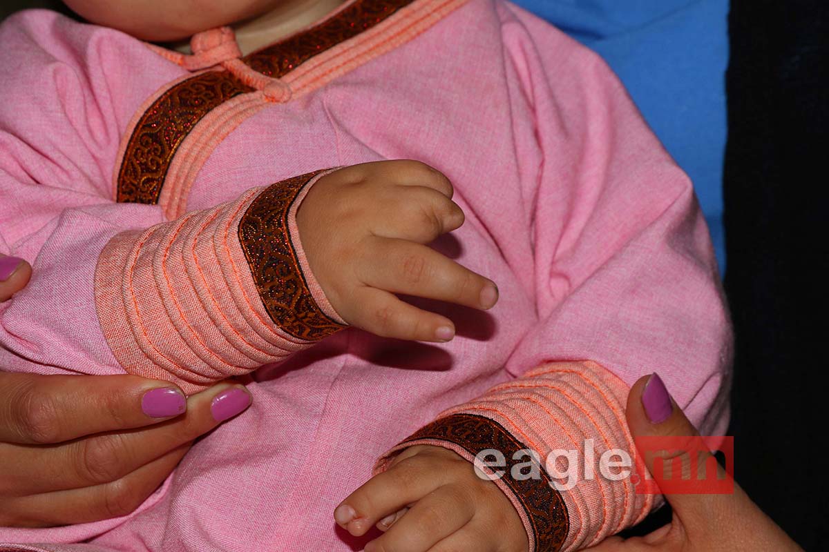 СУРВАЛЖЛАГА: Хоёр хөлөндөө дөрөвхөн хуруутай бяцхан охин Ш.Буянжаргалынд өнжлөө